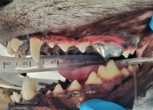 A crown on the left upper fourth premolar