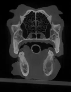 signs of infected teeth in dogs