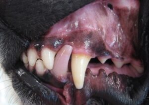 Discolored left lower canine tooth
