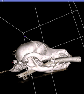 A pre-op ct scan of a jaw fracture