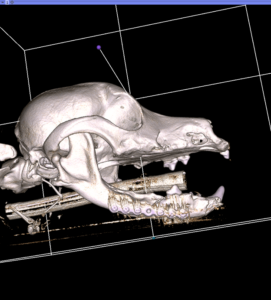 a post-op ct scan of a jaw fracture repair surgery